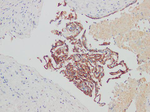 CA125 Antibody