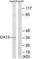 CA13 / Carbonic Anhydrase XIII Antibody - Western blot analysis of lysates from HepG2 cells, using CA13 Antibody. The lane on the right is blocked with the synthesized peptide.