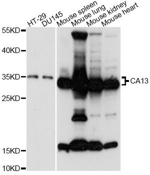 CA13 / Carbonic Anhydrase XIII Antibody - Western blot analysis of extracts of various cell lines, using CA13 antibody at 1:3000 dilution. The secondary antibody used was an HRP Goat Anti-Rabbit IgG (H+L) at 1:10000 dilution. Lysates were loaded 25ug per lane and 3% nonfat dry milk in TBST was used for blocking. An ECL Kit was used for detection and the exposure time was 90s.