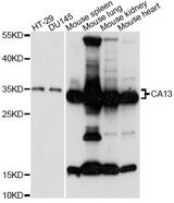 CA13 / Carbonic Anhydrase XIII Antibody - Western blot analysis of extracts of various cell lines, using CA13 antibody at 1:3000 dilution. The secondary antibody used was an HRP Goat Anti-Rabbit IgG (H+L) at 1:10000 dilution. Lysates were loaded 25ug per lane and 3% nonfat dry milk in TBST was used for blocking. An ECL Kit was used for detection and the exposure time was 90s.