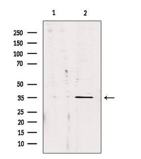 CA13 / Carbonic Anhydrase XIII Antibody - Western blot analysis of extracts of 293 cells using CA13 antibody. Lane 1 was treated with the blocking peptide.