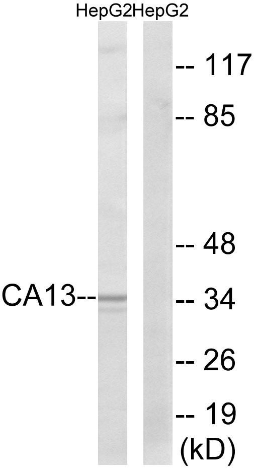 CA13 / Carbonic Anhydrase XIII Antibody - Western blot analysis of extracts from HepG2 cells, using CA13 antibody.