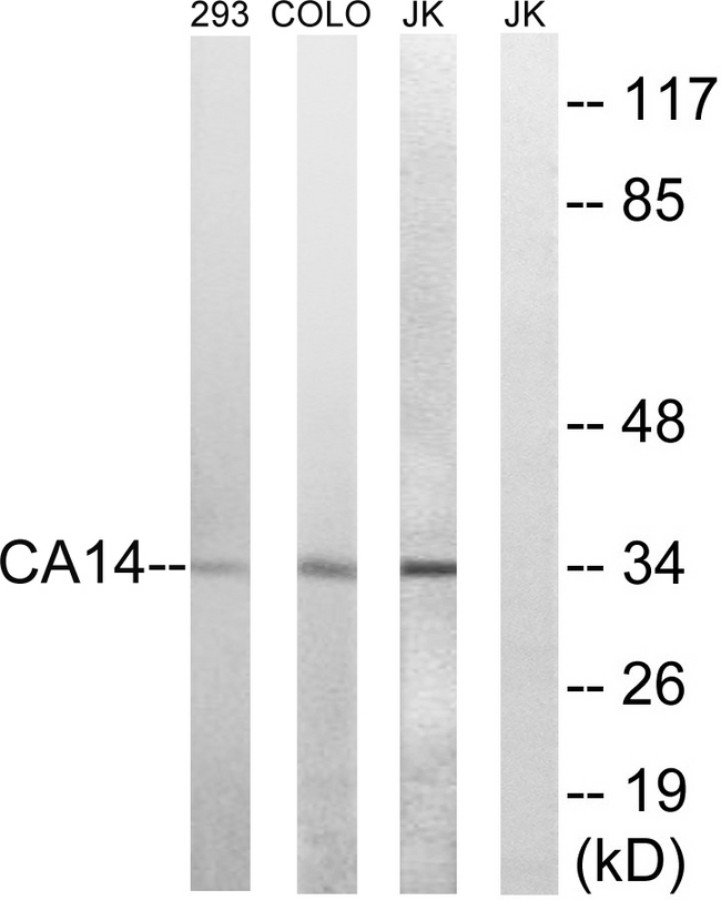 CA14 / Carbonic Anhydrase XIV Antibody - Western blot analysis of lysates from Jurkat, COLO, and 293 cells, using CA14 Antibody. The lane on the right is blocked with the synthesized peptide.