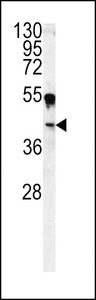 CA14 / Carbonic Anhydrase XIV Antibody - Western blot of CA14 antibody in A375 cell line lysates (35 ug/lane). CA14 (arrow) was detected using the purified antibody.