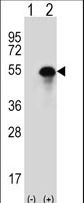 CA14 / Carbonic Anhydrase XIV Antibody - Western blot of CA14 (arrow) using rabbit polyclonal CA14 Antibody. 293 cell lysates (2 ug/lane) either nontransfected (Lane 1) or transiently transfected (Lane 2) with the CA14 gene.
