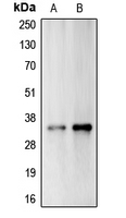 CA14 / Carbonic Anhydrase XIV Antibody - Western blot analysis of Carbonic Anhydrase 14 expression in A375 (A); Jurkat (B) whole cell lysates.