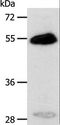 CA14 / Carbonic Anhydrase XIV Antibody - Western blot analysis of Human liver cancer tissue, using CA14 Polyclonal Antibody at dilution of 1:400.