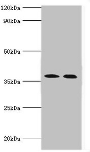 CA14 / Carbonic Anhydrase XIV Antibody - All  Lanes: Carbonic anhydrase 14 antibody at 5ug/ml Lane 1:mouse liver tissue Lane 2:jurkat whole cell lysate Secondary Goat polyclonal to rabbit at 1/10000 dilution Predicted band size: 38kDa Observed band size: 38kDa