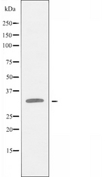 CA14 / Carbonic Anhydrase XIV Antibody - Western blot analysis of extracts of 293 cells, COLO cells, and Jurkat cells using CA14 antibody.
