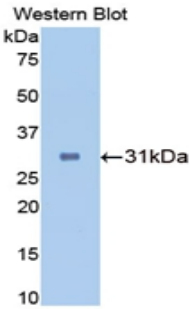 CA2 / Carbonic Anhydrase II Antibody - Western blot of recombinant CA2 / Carbonic Anhydrase II.  This image was taken for the unconjugated form of this product. Other forms have not been tested.