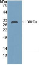 CA2 / Carbonic Anhydrase II Antibody - Western Blot; Sample: Recombinant CA2, Rat.