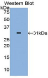 CA2 / Carbonic Anhydrase II Antibody - Western blot of recombinant CA2 / Carbonic Anhydrase II.  This image was taken for the unconjugated form of this product. Other forms have not been tested.
