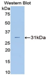 CA2 / Carbonic Anhydrase II Antibody - Western blot of recombinant CA2 / Carbonic Anhydrase II.  This image was taken for the unconjugated form of this product. Other forms have not been tested.