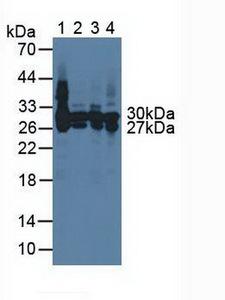 CA2 / Carbonic Anhydrase II Antibody - Western Blot; Sample: Lane1: Rat Serum; Lane2: Rat Liver Tissue; Lane3: Rat Heart Tissue; Lane4: Rat Spleen Tissue.