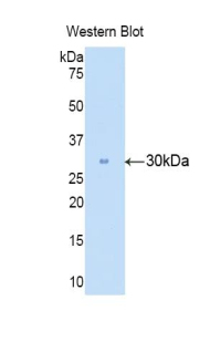 CA2 / Carbonic Anhydrase II Antibody - Western blot of recombinant CA2 / Carbonic Anhydrase II.  This image was taken for the unconjugated form of this product. Other forms have not been tested.
