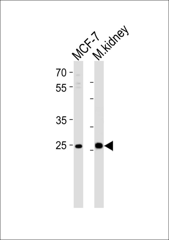 CA2 / Carbonic Anhydrase II Antibody - Western blot of lysates from MCF-7 cell line and mouse kidney tissue lysate (from left to right), using CA2 Antibody. Antibody was diluted at 1:1000 at each lane. A goat anti-rabbit IgG H&L (HRP) at 1:5000 dilution was used as the secondary antibody. Lysates at 35ug per lane.