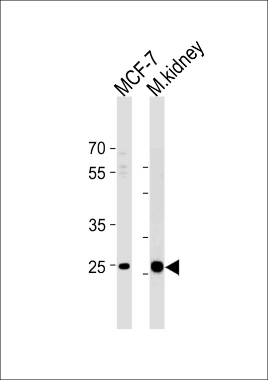 CA2 / Carbonic Anhydrase II Antibody - CA2 Antibody western blot of MCF-7 cell line and mouse kidney tissue lysates (35 ug/lane). The CA2 antibody detected the CA2 protein (arrow).