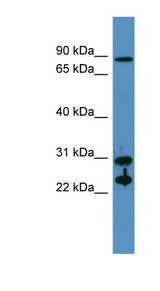 CA2 / Carbonic Anhydrase II Antibody - CA2 / Carbonic Anhydrase II antibody Western blot of Fetal Muscle lysate.  This image was taken for the unconjugated form of this product. Other forms have not been tested.