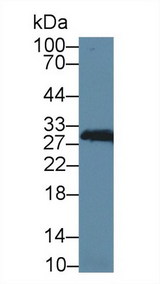 CA2 / Carbonic Anhydrase II Antibody