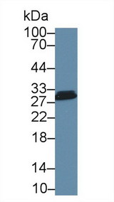 CA2 / Carbonic Anhydrase II Antibody