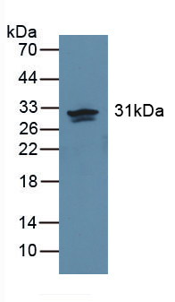 CA2 / Carbonic Anhydrase II Antibody
