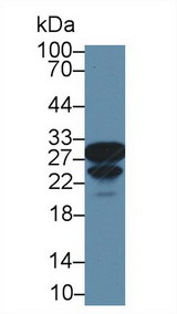 CA2 / Carbonic Anhydrase II Antibody