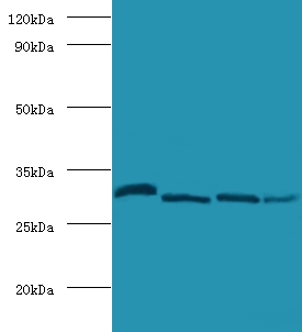 CA2 / Carbonic Anhydrase II Antibody - Western blot of Carbonic anhydrase 2 antibody at 2 ug/ml lane 1: mouse brain tissue lane 2: 293T whole cell lysate Lane 3: mouse heart tissue Lane 4: mouse liver tissue Secondary Goat polyclonal to Rabbit IgG at 1:10000 dilution.  This image was taken for the unconjugated form of this product. Other forms have not been tested.