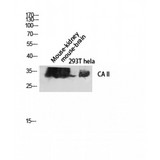 CA2 / Carbonic Anhydrase II Antibody - Western blot of CA II antibody