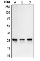 CA2 / Carbonic Anhydrase II Antibody - Western blot analysis of Carbonic Anhydrase 2 expression in Caco2 (A); K562 (B); Caki1 (C) whole cell lysates.