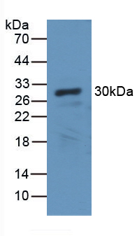 CA2 / Carbonic Anhydrase II Antibody