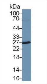 CA2 / Carbonic Anhydrase II Antibody