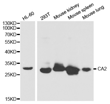 CA2 / Carbonic Anhydrase II Antibody - Western blot analysis of extracts of various cell lines, using CA2 antibody at 1:1000 dilution. The secondary antibody used was an HRP Goat Anti-Rabbit IgG (H+L) at 1:10000 dilution. Lysates were loaded 25ug per lane and 3% nonfat dry milk in TBST was used for blocking.