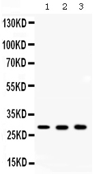 CA2 / Carbonic Anhydrase II Antibody - Western blot - Anti-ca2/Carbonic Anhydrase Ii Picoband Antibody