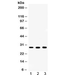 CA2 / Carbonic Anhydrase II Antibody - Western blot testing of 1) rat ovary, 2) mouse liver and 3) human MCF7 lysate with CA2 antibody at 0.5ug/m. Predicted/observed molecular weight ~29 kDa.
