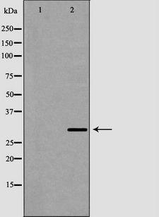 CA2 / Carbonic Anhydrase II Antibody - Western blot analysis of mouse kidney lysate using CA2 antibody. The lane on the left is treated with the antigen-specific peptide.