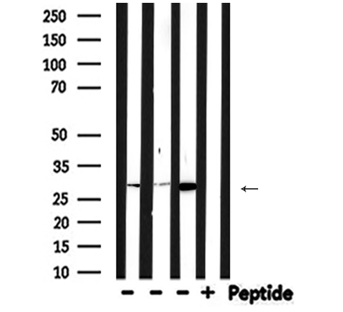 CA2 / Carbonic Anhydrase II Antibody - Western blot analysis of CA2 expression in various lysates