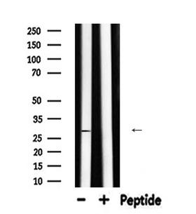 CA2 / Carbonic Anhydrase II Antibody - Western blot analysis of CA2 expression in mouse brain lysate 