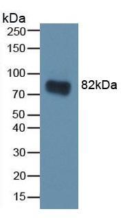 CA2 / Carbonic Anhydrase II Antibody