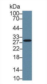 CA2 / Carbonic Anhydrase II Antibody