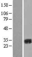 CA2 / Carbonic Anhydrase II Protein - Western validation with an anti-DDK antibody * L: Control HEK293 lysate R: Over-expression lysate