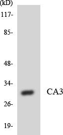 CA3 / Carbonic Anhydrase III Antibody - Western blot analysis of the lysates from HUVECcells using CA3 antibody.