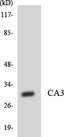 CA3 / Carbonic Anhydrase III Antibody - Western blot analysis of the lysates from HUVECcells using CA3 antibody.