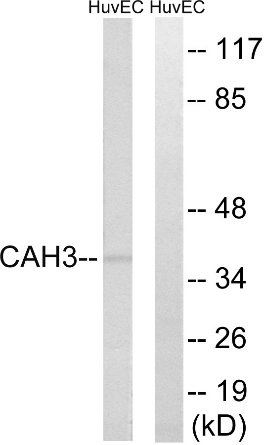 CA3 / Carbonic Anhydrase III Antibody - Western blot analysis of lysates from HUVEC cells, using CA3 Antibody. The lane on the right is blocked with the synthesized peptide.