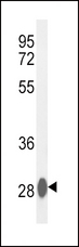 CA3 / Carbonic Anhydrase III Antibody - Western blot of CA3 Antibody in mouse liver tissue lysates (35 ug/lane). CA3 (arrow) was detected using the purified antibody.
