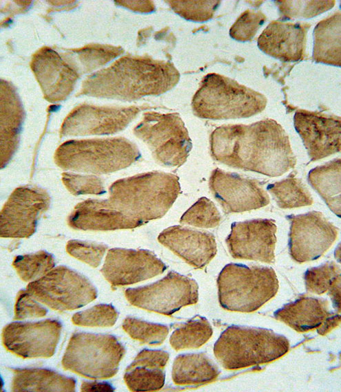 CA3 / Carbonic Anhydrase III Antibody - CA3 Antibody IHC of formalin-fixed and paraffin-embedded skeletal muscle followed by peroxidase-conjugated secondary antibody and DAB staining.