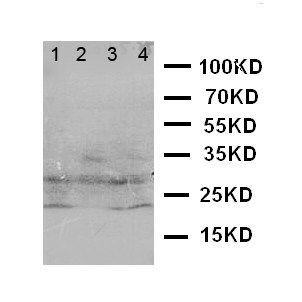 CA3 / Carbonic Anhydrase III Antibody - WB of CA3 / Carbonic Anhydrase III antibody. Lane 1: SMMC Cell Lysate. Lane 2: HELA Cell Lysate. Lane 3: SW620 Cell Lysate. Lane 4: SCG Cell Lysate.