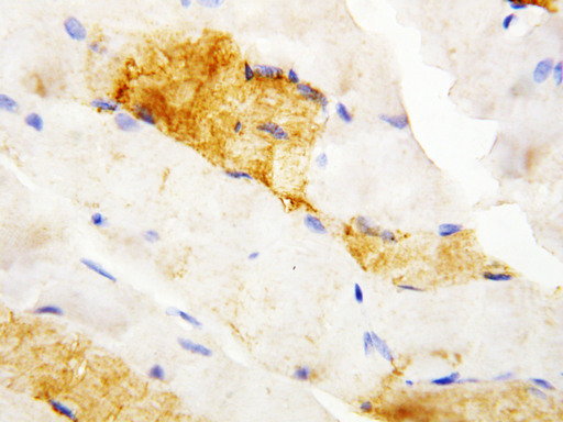 CA3 / Carbonic Anhydrase III Antibody - CA3 / Carbonic Anhydrase III antibody. IHC(P): Rat Skeletal Muscle Tissue.