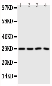 CA3 / Carbonic Anhydrase III Antibody - Anti-CA3 antibody, Western blotting Lane 1: SMMC Cell LysateLane 2: HELA Cell LysateLane 3: SW620 Cell LysateLane 4: SCG Cell Lysate