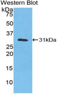 CA3 / Carbonic Anhydrase III Antibody - Western blot of recombinant CA3 / Carbonic Anhydrase III.  This image was taken for the unconjugated form of this product. Other forms have not been tested.