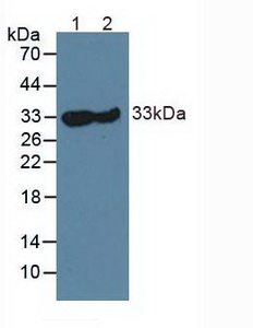 CA3 / Carbonic Anhydrase III Antibody - Western Blot; Lane1: Mouse Skeletal Muscle Tissue; Lane2: Rat Skeletal Muscle Tissue.